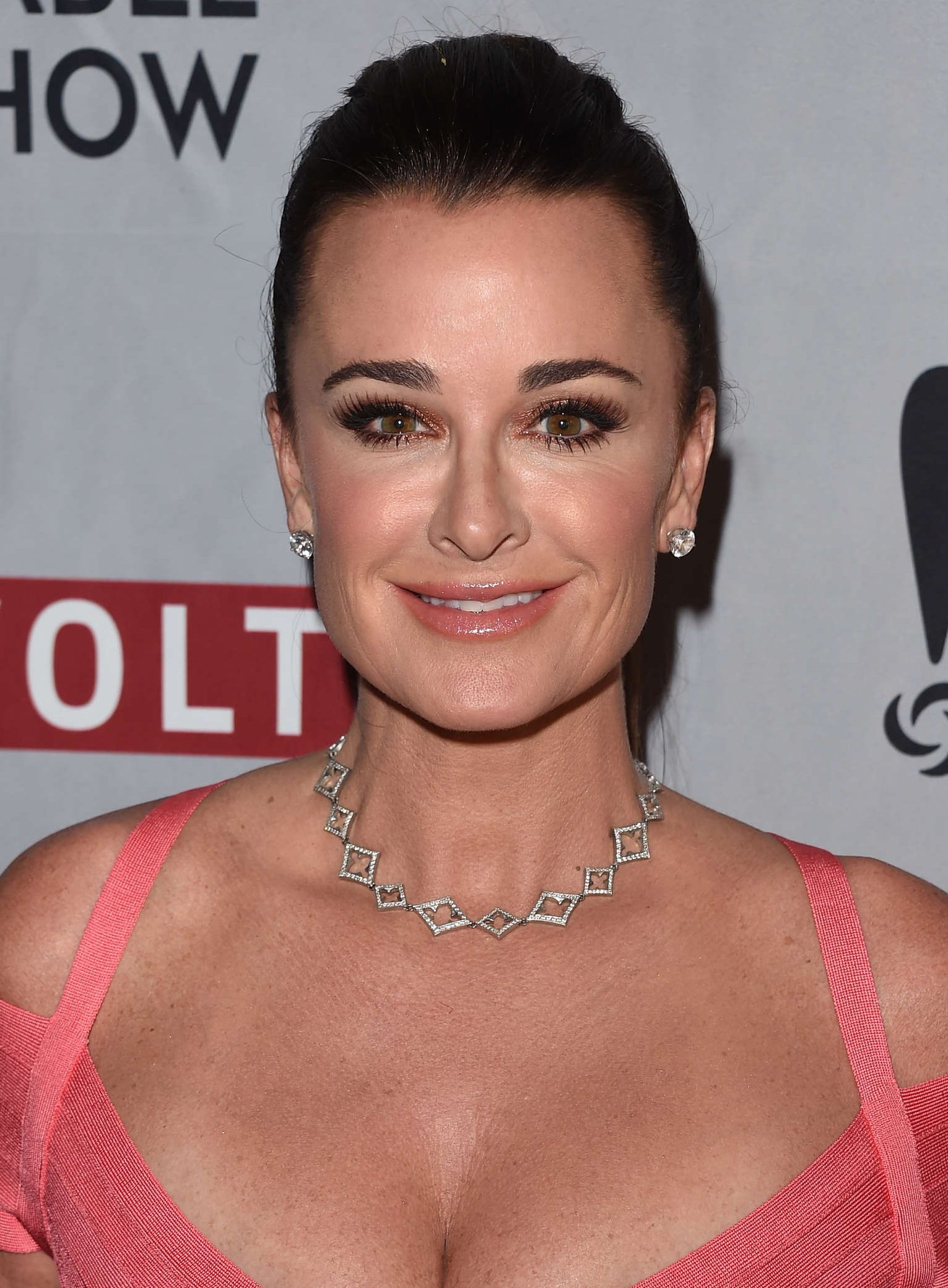 Kyle Richards plastic surgery 12.