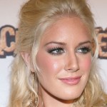 Heidi Montag plastic surgery 119