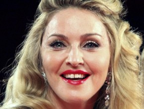 Madonna plastic surgery 1311