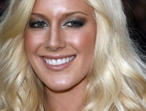 Heidi Montag plastic surgery 157