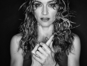 Madonna plastic surgery 166