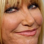 Suzanne Somers plastic surgery 203