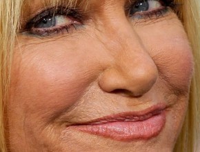 Suzanne Somers plastic surgery 203