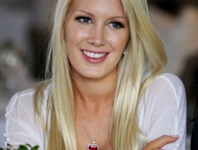 Heidi Montag plastic surgery 214