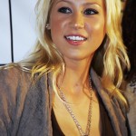 Ana Kournikova plastic surgery 221