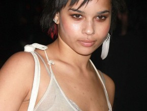 Zoë Isabella Kravitz plastic surgery 24