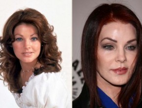 Priscilla Presley before and after plastic surgery