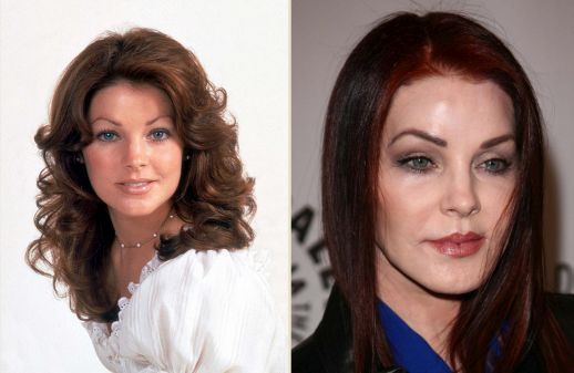 Priscilla Presley before and after plastic surgery