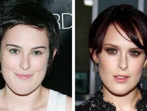 Rumer Willis before and after plastic surgery 01