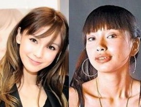 Angelababy before and after plastic surgery 01
