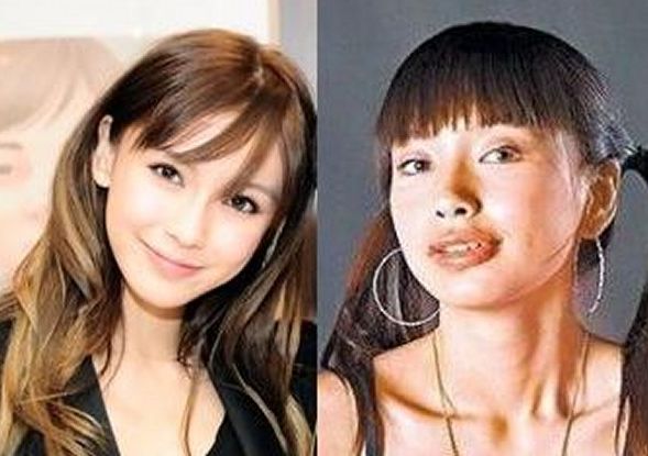 Angelababy before and after plastic surgery 01
