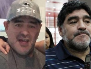 Diego Maradona plastic surgery