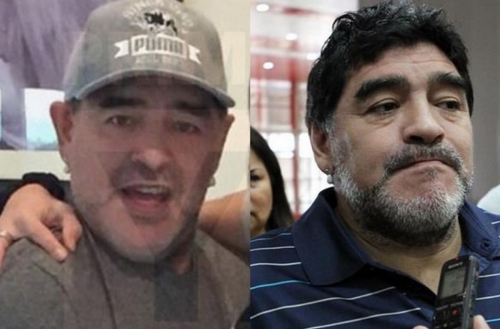 Diego Maradona plastic surgery