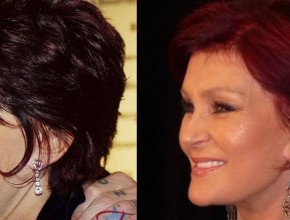 Sharon Osbourne  before and after plastic surgery