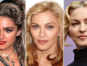 Madonna before and after plastic surgery