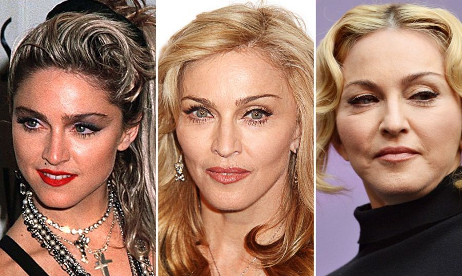 Madonna before and after plastic surgery