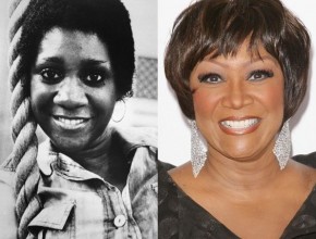 Patti Labelle before and after plastic surgery