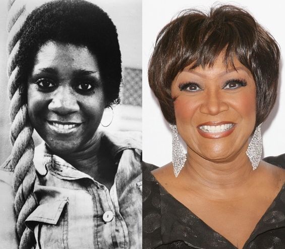 Patti Labelle before and after plastic surgery