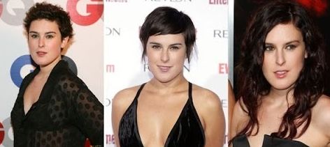 Rumer Willis plastic surgery