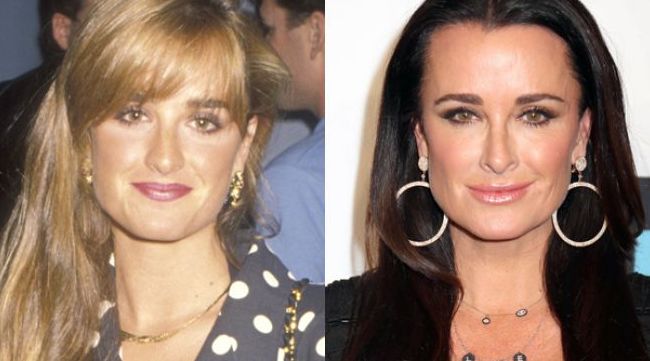 Kyle Richards before and after plastic surgery 3