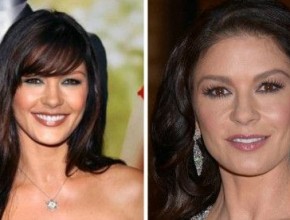 Catherine Zeta Jones before and after plastic surgery