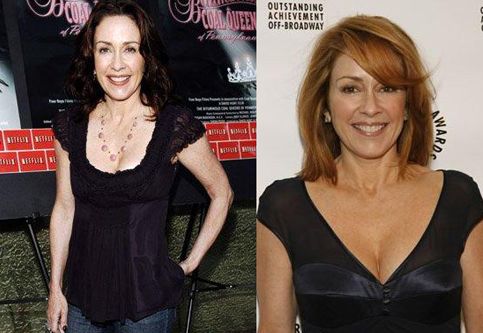 Patricia Heaton tummy tuck