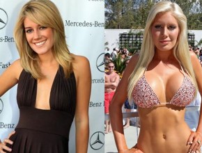 Heidi Montag plastic surgery