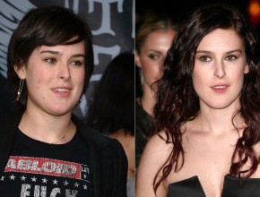 Rumer Willis before and after plastic surgery 51