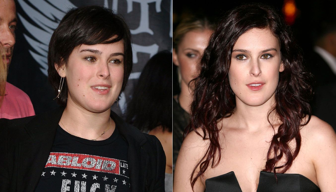 Rumer Willis plastic surgery