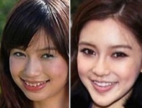 Angelababy before and after plastic surgery 52