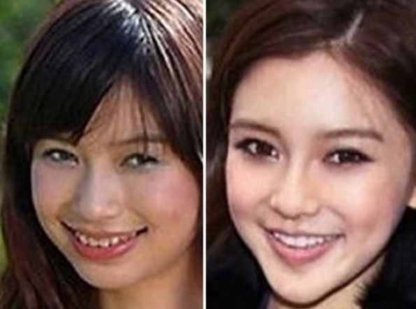 Angelababy before and after plastic surgery 52