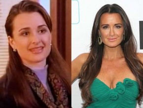 Kyle Richards before and after plastic surgery 5