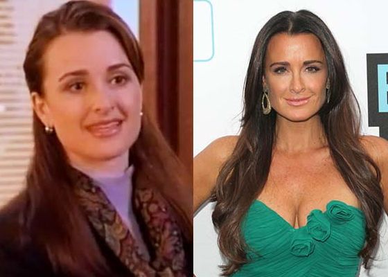 Kyle Richards before and after plastic surgery 5