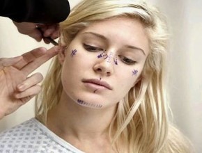 Heidi Montag plastic surgery