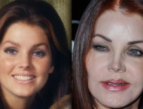 Priscilla Presley before and after plastic surgery 6