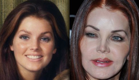Priscilla Presley before and after plastic surgery 6