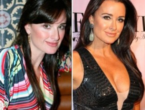 Kyle Richards before and after plastic surgery 6
