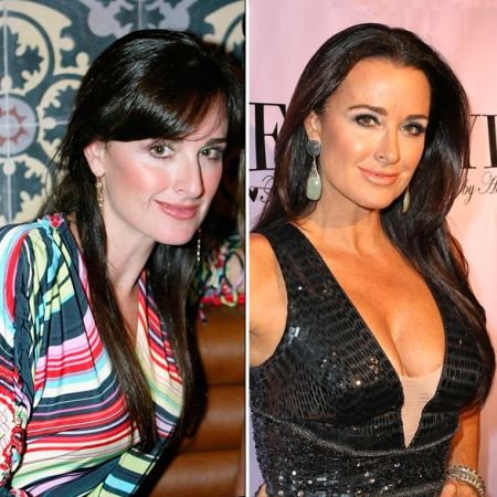 Kyle Richards before and after plastic surgery 6