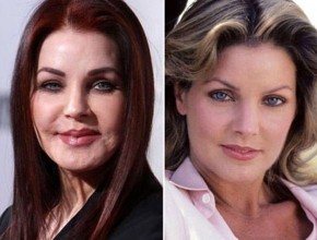 Priscilla Presley before and after plastic surgery 7