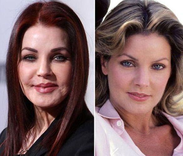 Priscilla Presley before and after plastic surgery 7
