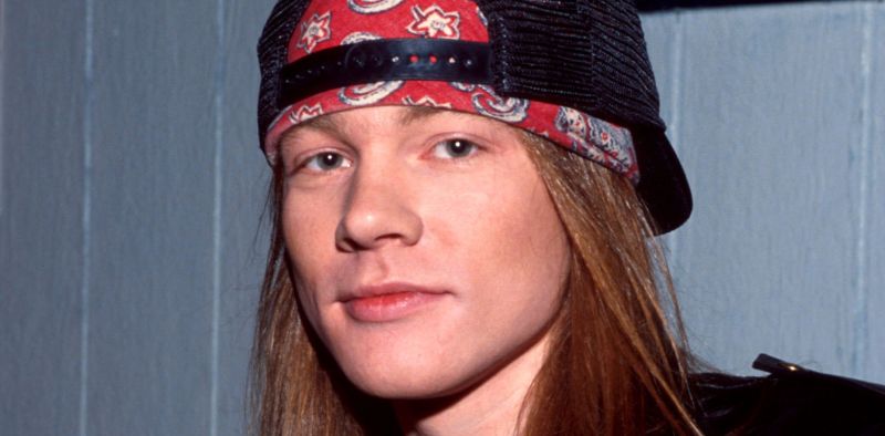 Axl Rose, his appearance before and after plastic surgery