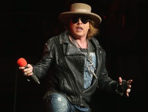 Axl Rose plastic surgery before and after 14