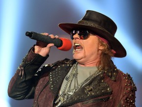 Axl Rose plastic surgery  44