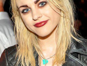 Frances Bean Cobain after plastic surgery 516