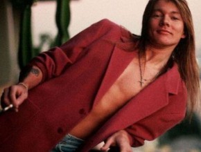 Axl Rose plastic surgery  54