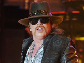 Axl Rose plastic surgery  74