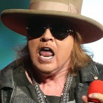 Axl Rose plastic surgery  84