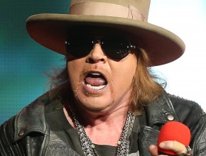 Axl Rose plastic surgery  84