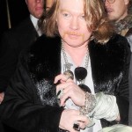 Axl Rose plastic surgery  94