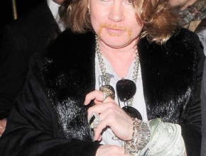 Axl Rose plastic surgery  94